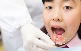 前歯が気になる方へ前歯の矯正に適した矯正装置「インビザラインgo」